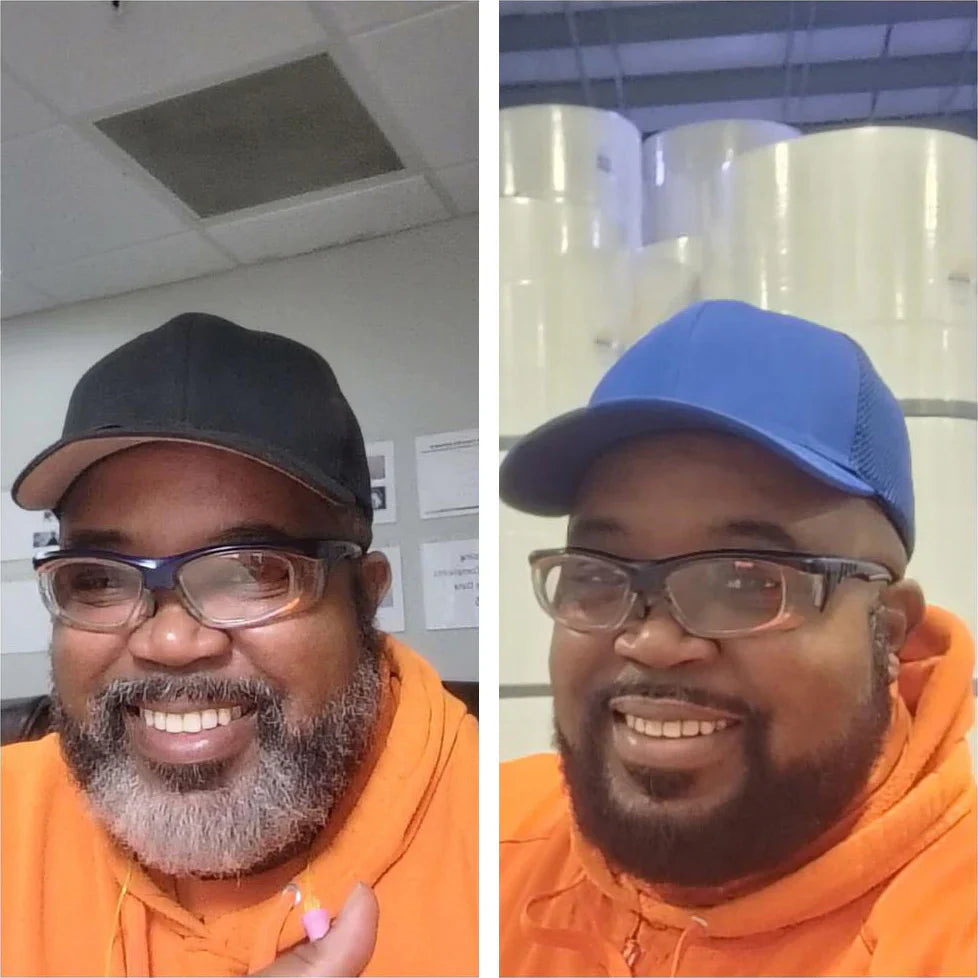 AKTALO - 🇨🇮 Dites Adieu aux cheveux blancs EN 8 MINUTES ! Garantie Satisfait ou remboursé