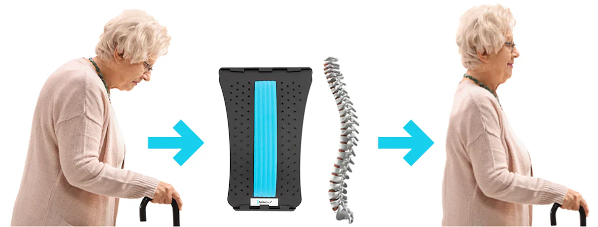 Arc d'étirement lombaire