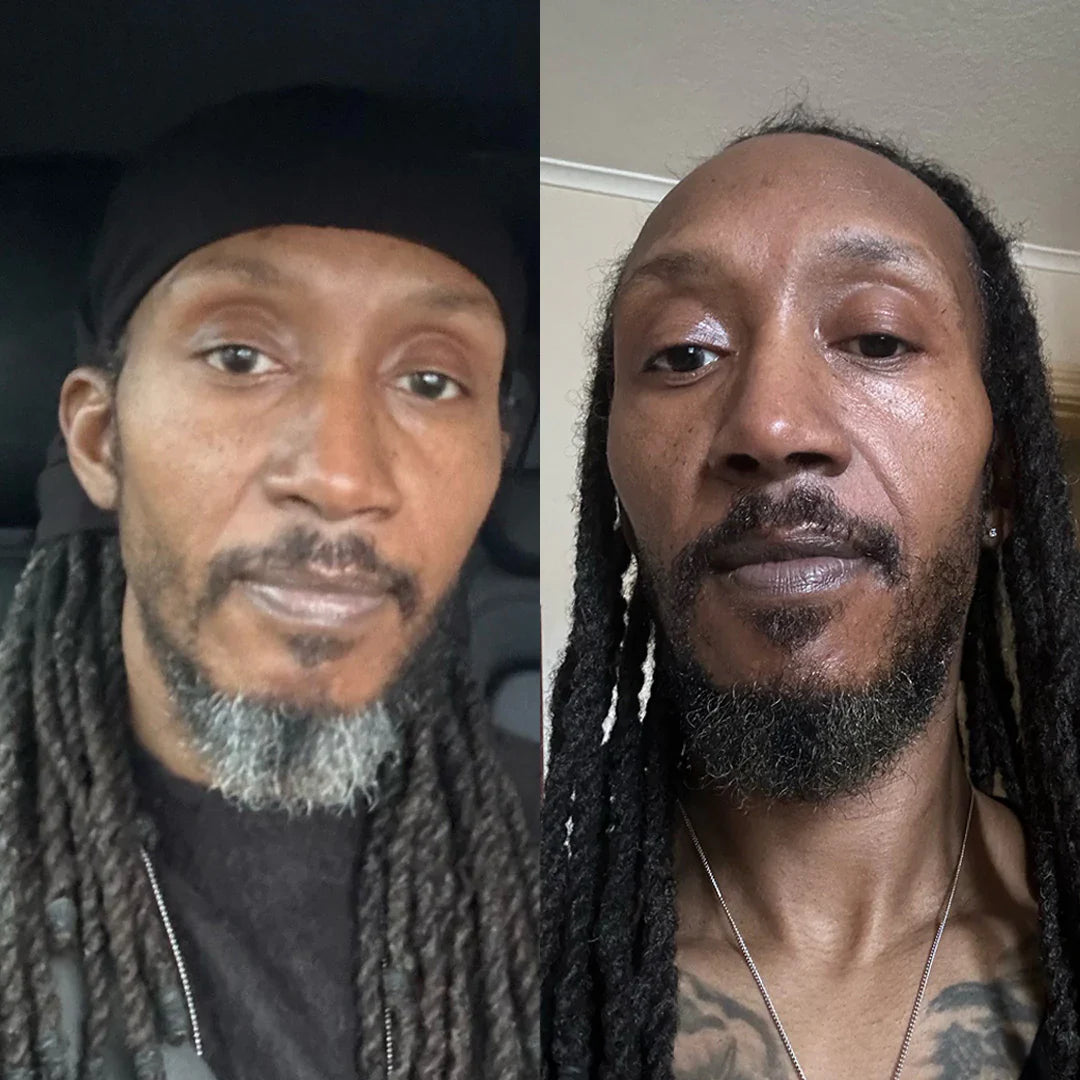 AKTALO - 🇨🇮 Dites Adieu aux cheveux blancs EN 8 MINUTES ! Garantie Satisfait ou remboursé